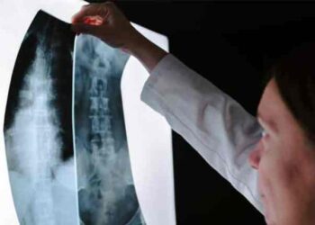 Spinal Cord Injury Attorneys Denver