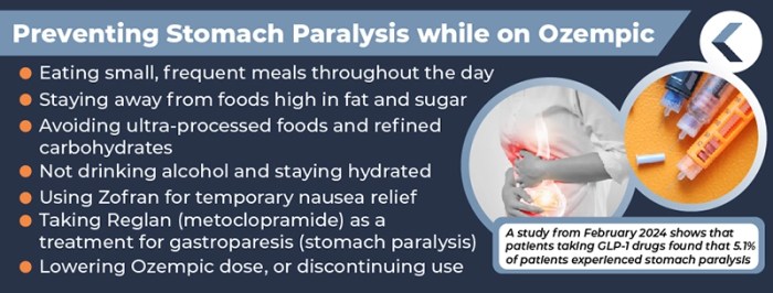 Ozempic Stomach Paralysis Lawsuit [2025 Update] - King Law