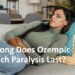 Gastroparesis and Ozempic: Understanding Stomach Paralysis | 15 minute ...