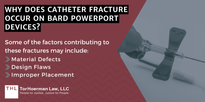 [2023 Update] Bard PowerPort Catheter Fracture Lawsuit